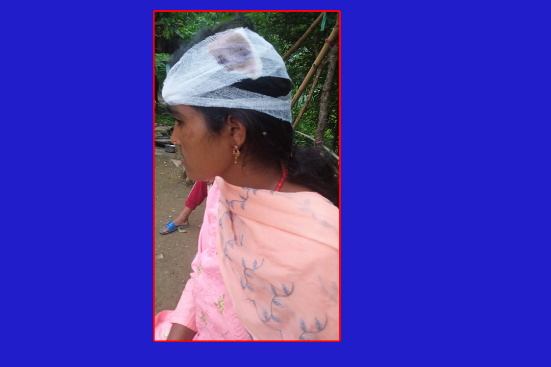 बैतडीमा सासुले बुहारीको टाउकोमा हसिया प्रहार गरेपछि ...